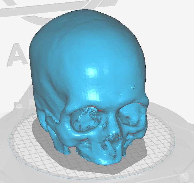 cerebro en 3D